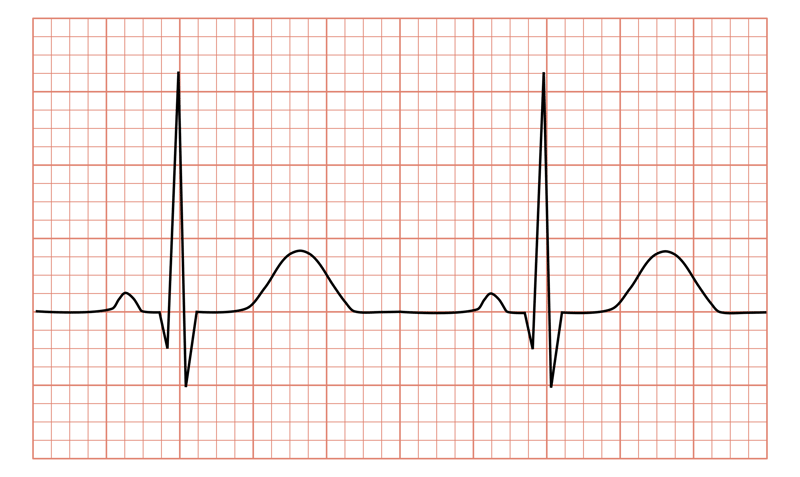 Friskt EKG